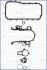 Комплект прокладок, блок-картер двигателя AJUSA 54219100 (фото 1)