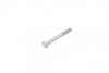 Комплект ГРМ + ТНВД VW LT 96-06/VW T4 2.5TDI 91-03/Volvo S70/S80 2.5TDI 97-06 (20.8x81z/26.4x122z) Contitech CT939K10PRO (фото 20)