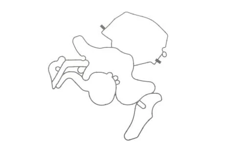 Прокладка передньої кришки двигуна ELRING 122.472