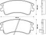 Тормозные колодки передные Mazda 6 2.0/2.0DI/2.3 02- Jurid 572482J (фото 1)