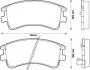Тормозные колодки передные Mazda 6 2.0/2.0DI/2.3 02- Jurid 572482J (фото 1)