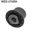 Балка осі SKF VKDS 474004 (фото 1)