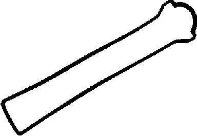 Прокладка клапанної кришки VICTOR REINZ 71-52577-00